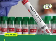GHS CONFIRMS SECOND MPOX CASE