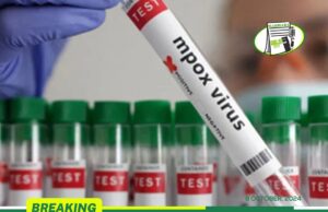 GHS CONFIRMS SECOND MPOX CASE