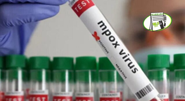 GHS CONFIRMS SECOND MPOX CASE
